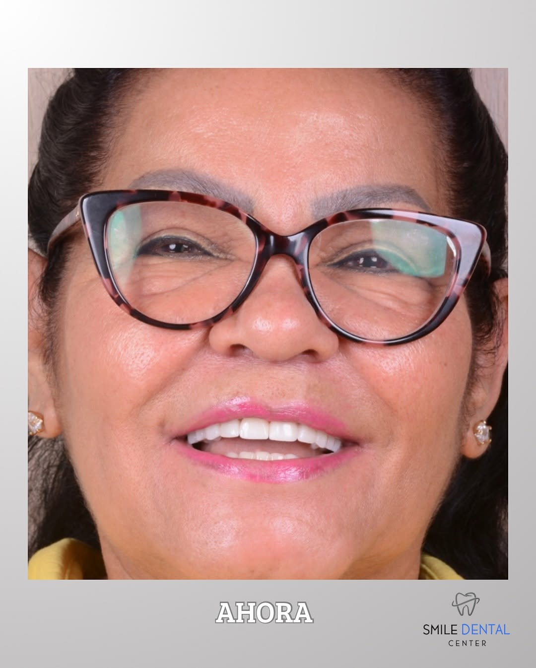 Sonrisa después del tratamiento